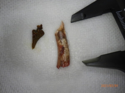 左が小腸内の骨片、右が胃内の骨