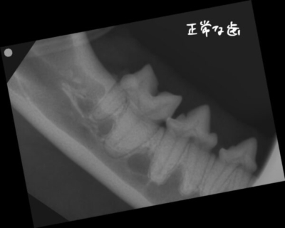 正常な歯との比較