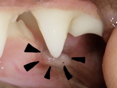 下の歯茎にあたり孔を開けている
