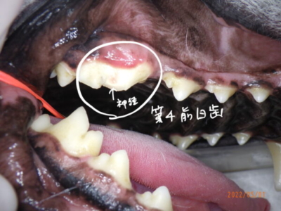 犬 歯 欠け た